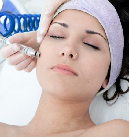 Peeling de Diamante (1 sessão)